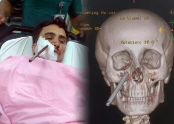 Giresun’da korkunç olay! İnşaat demiri yüzüne saplandı