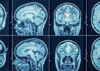 Nöbet geçiren adam Fransızca konuşmaya başladı