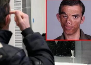 İşte yüz nakli yapılan Uğur Acar’ın 10 yıl sonraki hali