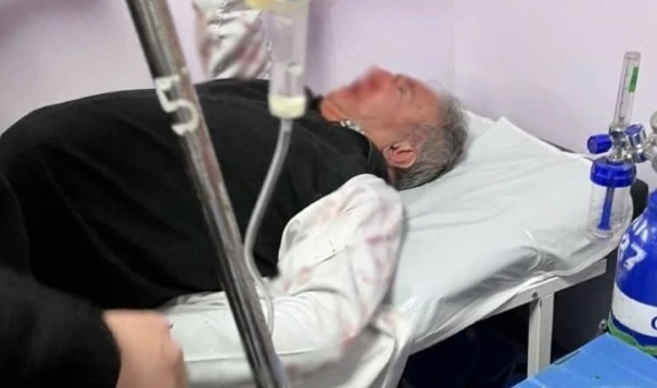 İstanbul’da aile hekimine saldırı