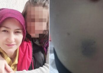 Ev içi şiddet gören kadının yardım çığlığı: “Akıl sağlığımızı kaybetmek üzereyiz”