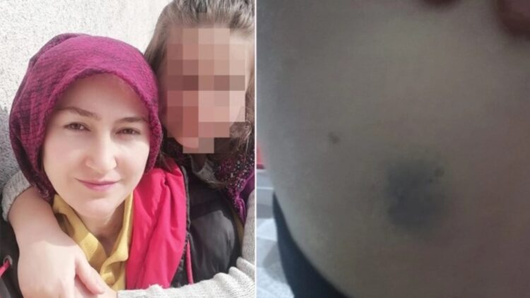 Ev içi şiddet gören kadının yardım çığlığı: “Akıl sağlığımızı kaybetmek üzereyiz”