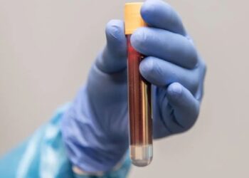 Alzheimer’ı teşhis eden kan testi geliştirildi