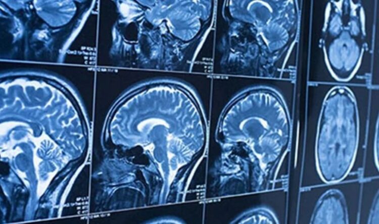 Prof. Dr. Güven’den Menenjit alarmı: İnatçı ateş, bilinç değişikliği…