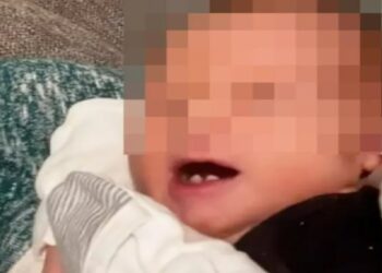 Dişleriyle doğan bebeği görenler gözlerine inanamadı