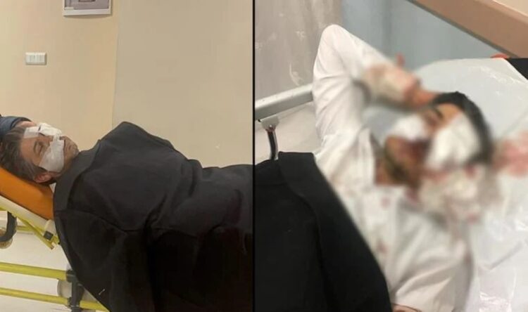 Sivas Ziraat Odası Genel Sekreteri’ne saldırı