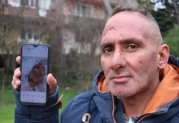 Sinek ısırığıyla hayatının kabusunu yaşadı!