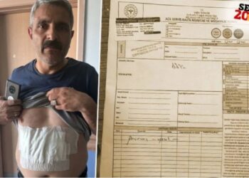 Blok oy kullanmasına karşı çıktı: Üstüne kaynar su döküldü