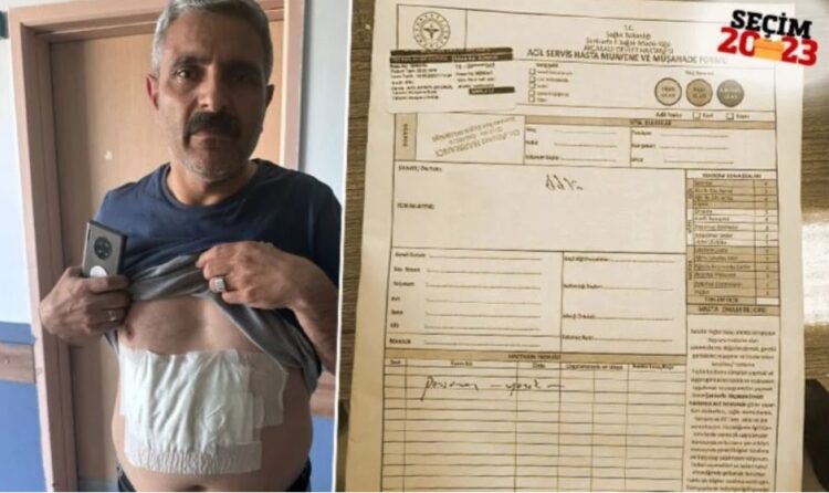 Blok oy kullanmasına karşı çıktı: Üstüne kaynar su döküldü