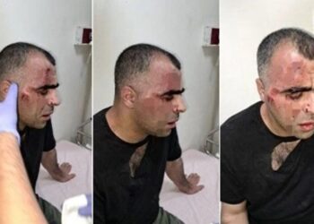 Gazeteci Sinan Aygül’e saldıran belediye çalışanı ile bir polis açığa alındı