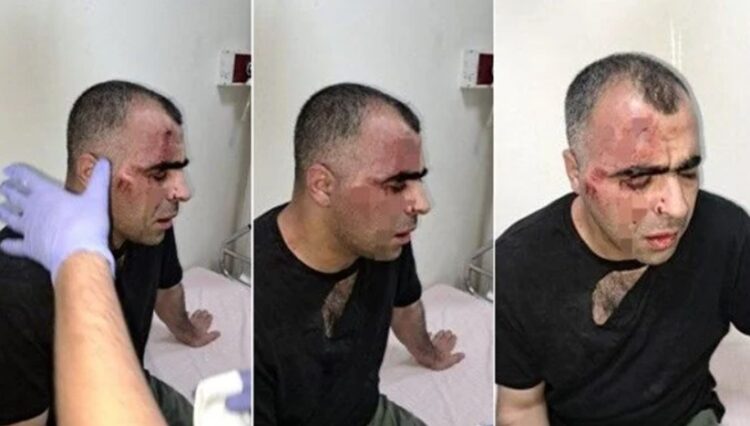 Gazeteci Sinan Aygül’e saldıran belediye çalışanı ile bir polis açığa alındı