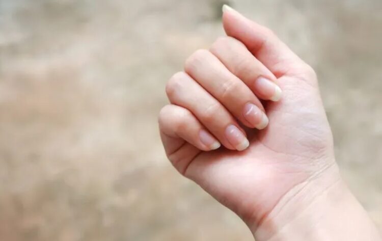 İşte tırnaklardaki beyazlığın nedeni