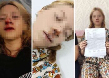 Yüzüne kaldırım taşı atıp dişlerini kırdılar