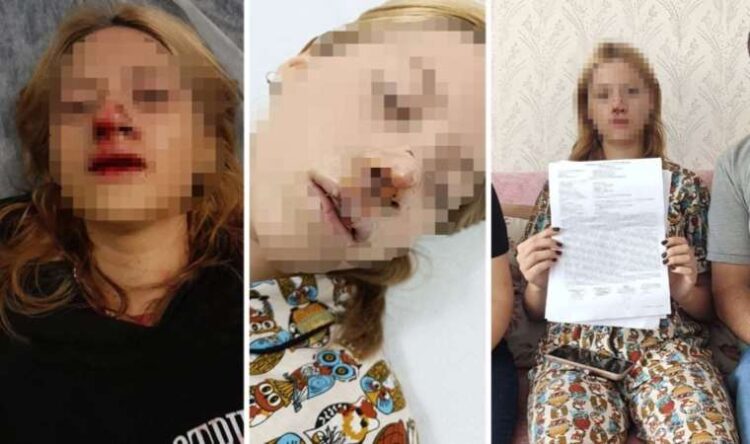 Yüzüne kaldırım taşı atıp dişlerini kırdılar