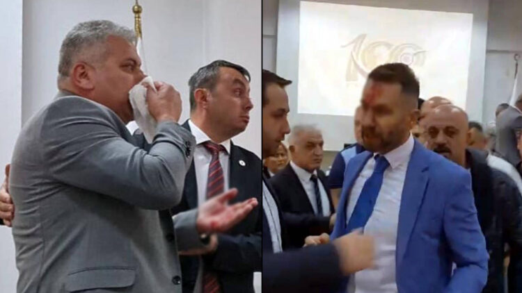 MHP’li belediye meclis üyesi, CHP’li üyeye kafa atıp burnunu kırdı