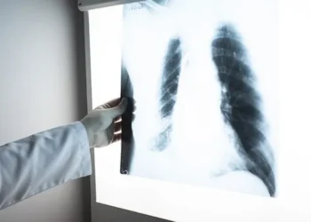 Silikozise yakalanan işçiler 13 yıldır adalet bekliyor